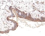 PSMC5 Antibody in Immunohistochemistry (Paraffin) (IHC (P))