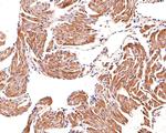 PSMD2 Antibody in Immunohistochemistry (Paraffin) (IHC (P))