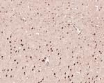 PSMD7 Antibody in Immunohistochemistry (Paraffin) (IHC (P))