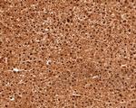 RUVBL1 Antibody in Immunohistochemistry (Paraffin) (IHC (P))