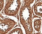 RUVBL1 Antibody in Immunohistochemistry (Paraffin) (IHC (P))