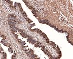 RUVBL1 Antibody in Immunohistochemistry (Paraffin) (IHC (P))