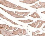 RUVBL1 Antibody in Immunohistochemistry (Paraffin) (IHC (P))