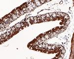 BTRC Antibody in Immunohistochemistry (Paraffin) (IHC (P))