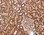 TIMM23 Antibody in Immunohistochemistry (Paraffin) (IHC (P))