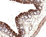 TIMM23 Antibody in Immunohistochemistry (Paraffin) (IHC (P))