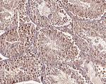 PSMD11 Antibody in Immunohistochemistry (Paraffin) (IHC (P))