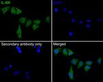 IL-6 Receptor Antibody in Immunocytochemistry (ICC/IF)