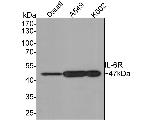 IL-6 Receptor Antibody in Western Blot (WB)