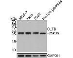 CLBT Antibody in Western Blot (WB)