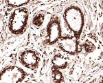 PSMB3 Antibody in Immunohistochemistry (Paraffin) (IHC (P))