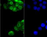 GLI1 Antibody in Immunocytochemistry (ICC/IF)