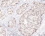 TBP Antibody in Immunohistochemistry (Paraffin) (IHC (P))