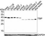 TBP Antibody in Western Blot (WB)