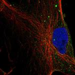 Monoacylglycerol Lipase Antibody in Immunocytochemistry (ICC/IF)