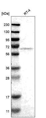 FKBP10 Antibody in Western Blot (WB)