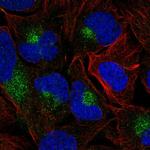 SH3BGRL Antibody in Immunocytochemistry (ICC/IF)