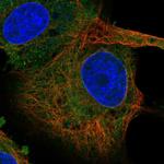 SC4MOL Antibody in Immunocytochemistry (ICC/IF)