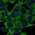 N4BP2L1 Antibody in Immunocytochemistry (ICC/IF)