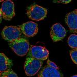 STAP1 Antibody in Immunocytochemistry (ICC/IF)