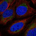 IRG1 Antibody in Immunocytochemistry (ICC/IF)