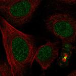 L3MBTL1 Antibody in Immunocytochemistry (ICC/IF)