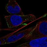 ADAMTS16 Antibody in Immunocytochemistry (ICC/IF)