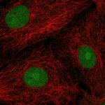 POP4 Antibody in Immunocytochemistry (ICC/IF)