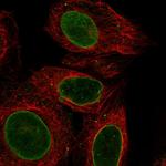 DBX2 Antibody in Immunocytochemistry (ICC/IF)