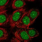 DEDD Antibody in Immunocytochemistry (ICC/IF)