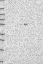 TFEB Antibody in Western Blot (WB)