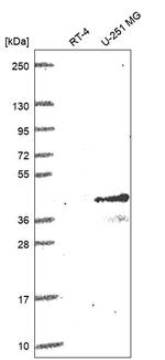 CD1c Antibody in Western Blot (WB)