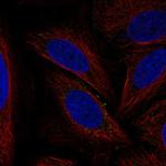 ATG12 Antibody in Immunocytochemistry (ICC/IF)