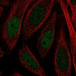 JMJD2B Antibody in Immunocytochemistry (ICC/IF)