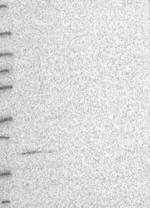 ST6GALNAC6 Antibody in Western Blot (WB)