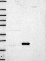 K-Ras Antibody in Western Blot (WB)