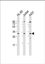 Caspase 3 Antibody in Western Blot (WB)