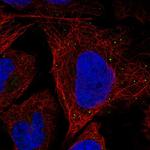 SLITRK5 Antibody in Immunocytochemistry (ICC/IF)