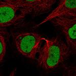 RAD21 Antibody in Immunocytochemistry (ICC/IF)