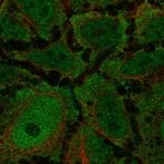 CCKAR Antibody in Immunocytochemistry (ICC/IF)