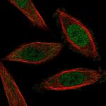 NFAT5 Antibody in Immunocytochemistry (ICC/IF)