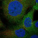 Apolipoprotein J Antibody in Immunocytochemistry (ICC/IF)