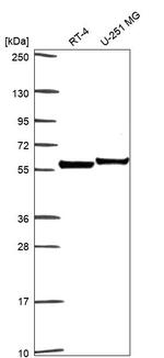 Apolipoprotein J Antibody in Western Blot (WB)