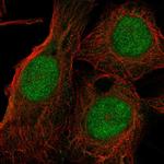 TXNL4A Antibody in Immunocytochemistry (ICC/IF)