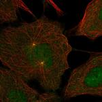 DNAJC28 Antibody in Immunocytochemistry (ICC/IF)