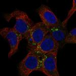 SNX2 Antibody in Immunocytochemistry (ICC/IF)