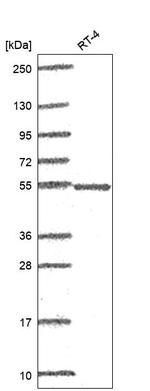 POLG2 Antibody in Western Blot (WB)