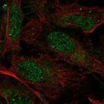 PRPF39 Antibody in Immunocytochemistry (ICC/IF)