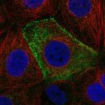 CSAD Antibody in Immunocytochemistry (ICC/IF)