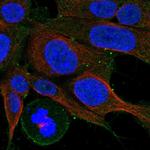 CCKBR Antibody in Immunocytochemistry (ICC/IF)